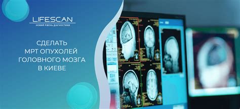 Революционный радиофармпрепарат «Медицина и ядерные технологии»: новая эра в диагностике опухолей головного мозга